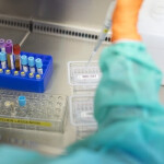 Come ti sconfiggo l'HIV in Svizzera